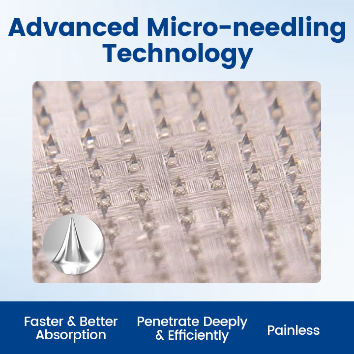 Alisanda® Vein Ease Microneedle Therapy Patch - Fast ⚡Effective 💪 and Non-Invasive 🚫 Treatment for Varicose Veins & Leg Swelling 👣