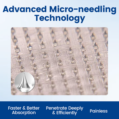 Alisanda® Vein Ease Microneedle Therapy Patch - Fast ⚡Effective 💪 and Non-Invasive 🚫 Treatment for Varicose Veins & Leg Swelling 👣